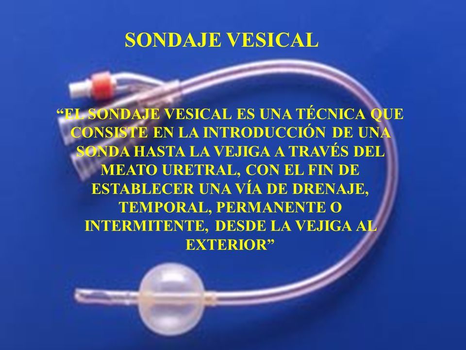 cateterismo vesical e irrigaciÓn el sondaje vesical es una tÉcnica